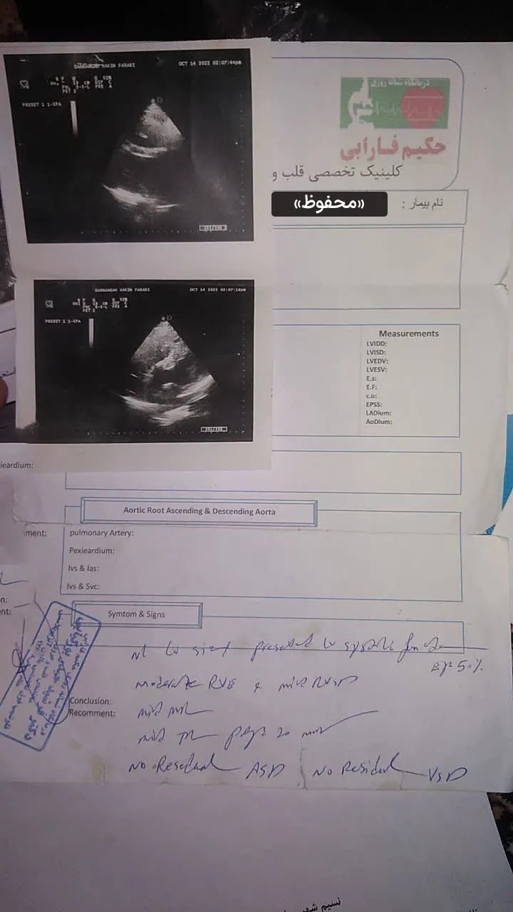 تصاویر سونوگرافی و اکوکاردیوگرافی تخصصی قلب بیمار در کلینیک درمانی